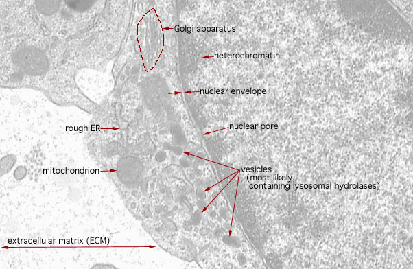  macrophage and eosinophil, macrophage cytoplasm 